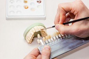 Facial Dental Prosthetic.
