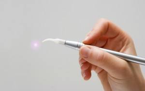 hand-with-dental-laser-system-000019128512_Medium