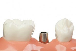 iStock_000023710117_Small
